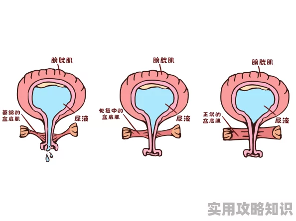 失禁漏尿羞耻野外排泄：许多人认为这种情况令人尴尬，但也有人呼吁理解与包容，强调自然生理现象